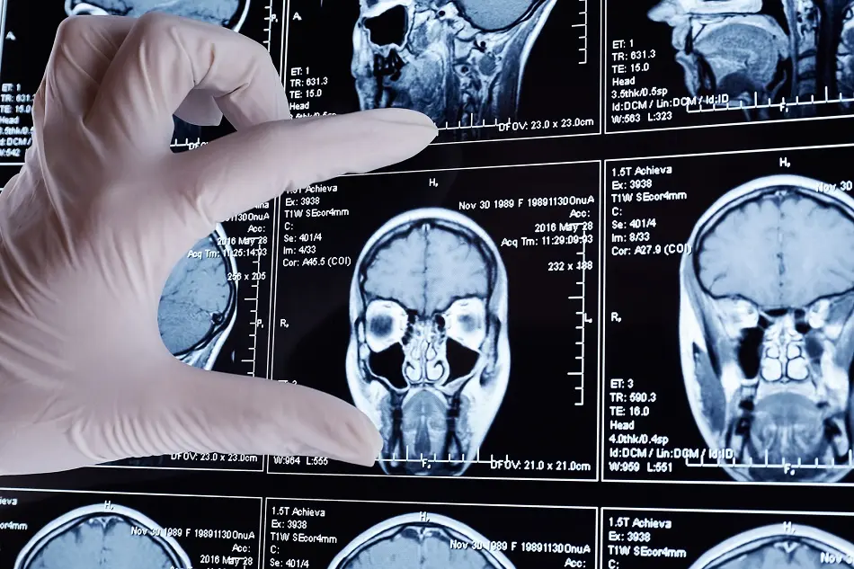 Inteligencia Artificial en Imágenes Médicas - Cómo funciona la inteligencia artificial que crea imágenes inteligencia artificial en imagenes medicas - Cómo funciona la inteligencia artificial que crea imágenes