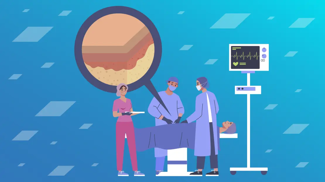 Piel inteligente: La revolución tecnológica en el campo de la detección y percepción - Cómo funciona la piel artificial piel inteligente - Cómo funciona la piel artificial