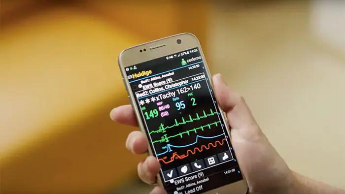 alarmas inteligentes en enfermeria - Cómo funcionan las alarmas para camas de hospital
