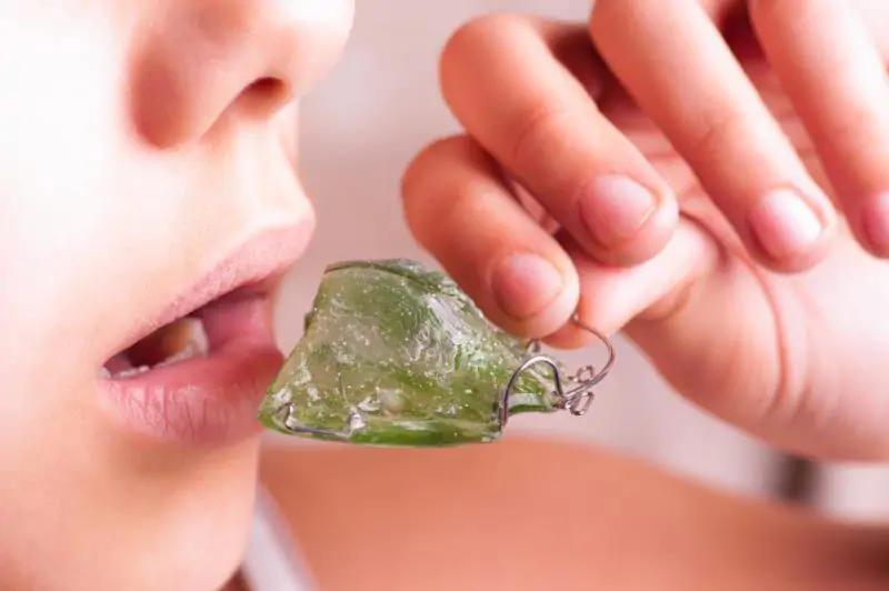 Ortodoncia inteligente: la revolución en el tratamiento dental - Cómo se llama el aparato para corregir la mordida en niños ortodoncia inteligente - Cómo se llama el aparato para corregir la mordida en niños
