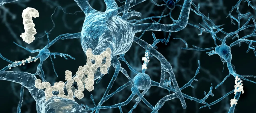 Deterioro de la inteligencia en el Alzheimer: causas, síntomas y tratamiento - Cuáles son las 7 etapas del Alzheimer deterioro inteligencia alzheimer - Cuáles son las 7 etapas del Alzheimer
