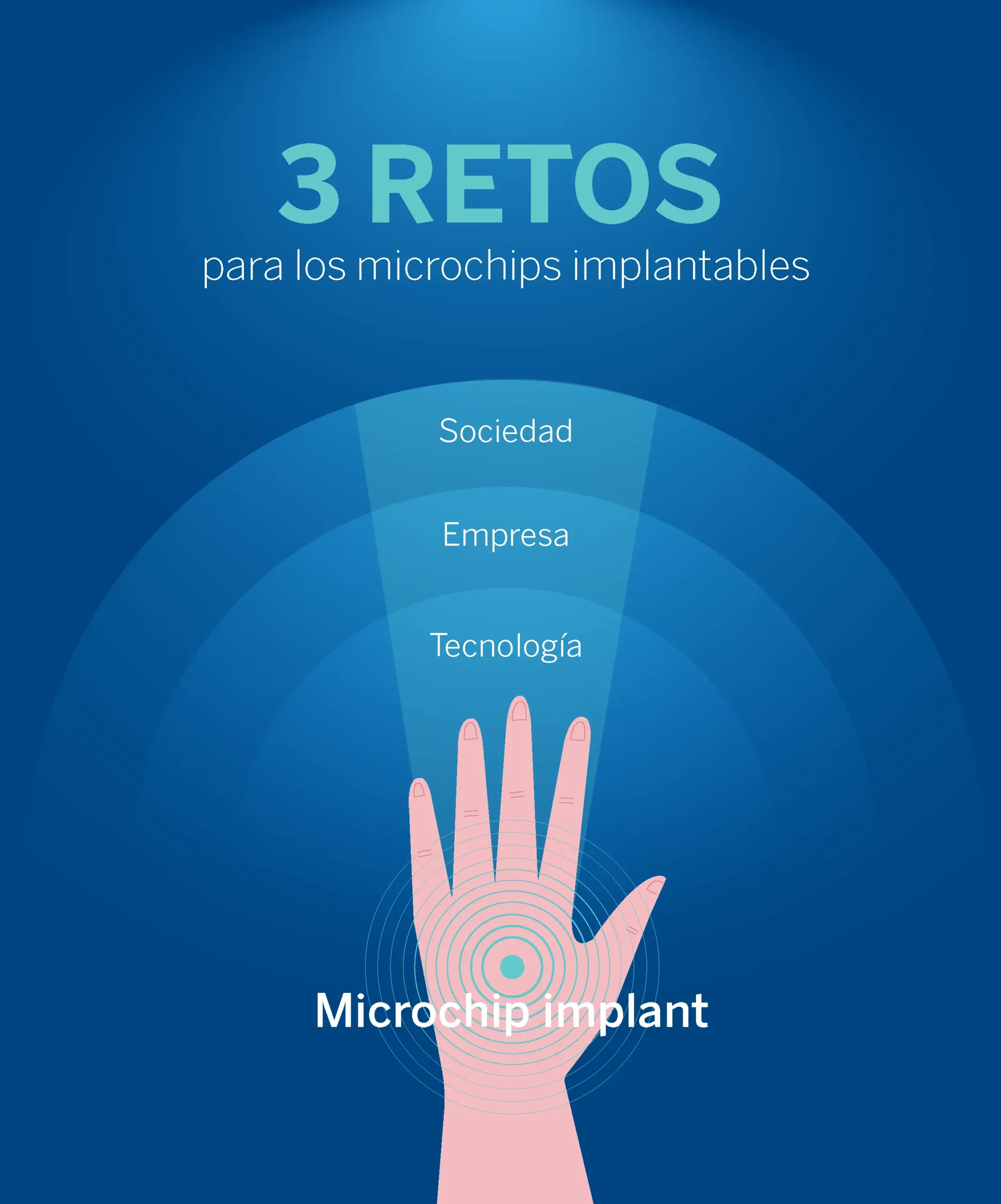 productos inteligentemente implantables - Cuáles son los dispositivos médicos implantables