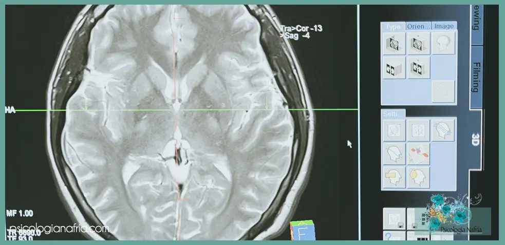 test de inteligencia para determinar lesion cerebral para adolescentes - Cuáles son los test Neuropsicologicos