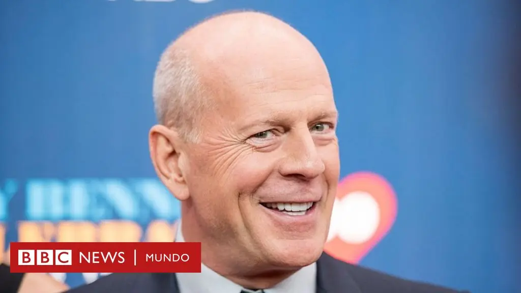 calvicie inteligencia - Cuanto más pelo más testosterona