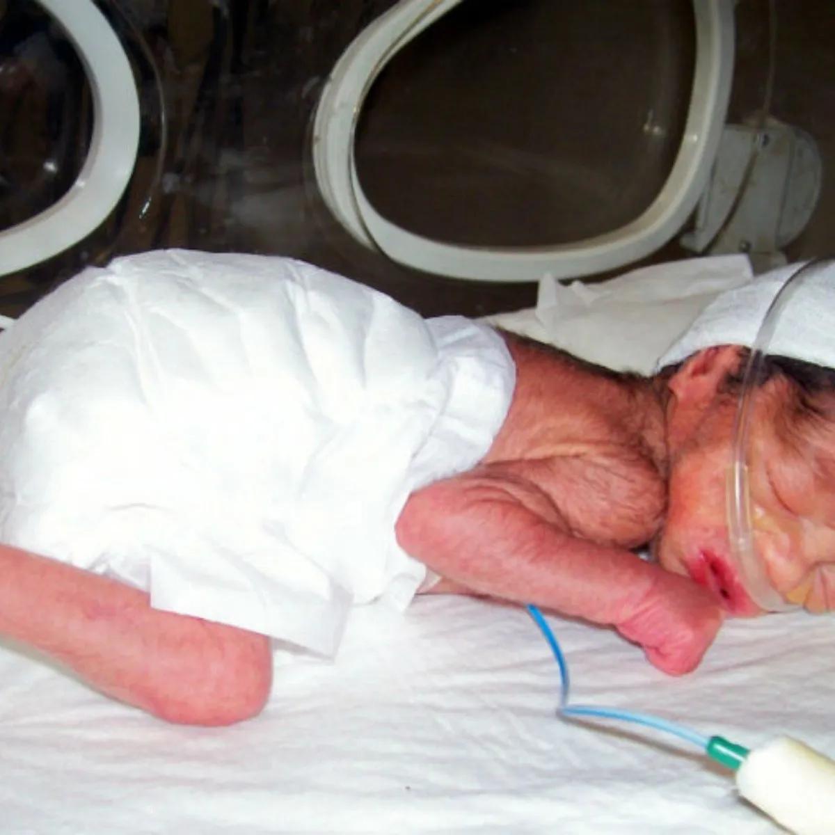 cuna inteligente para bebes prematuros - Dónde ponen a los bebés prematuros