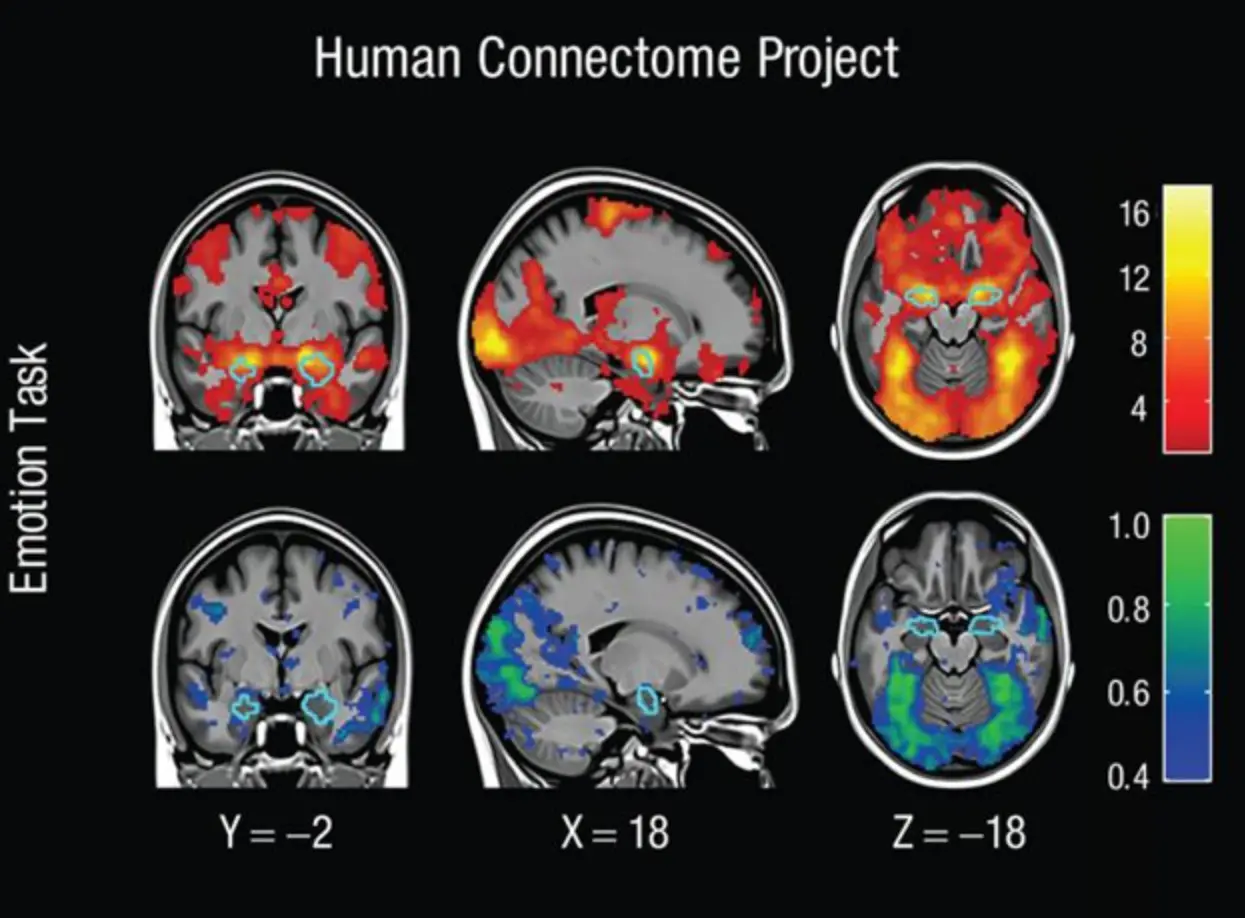 cerebros inteligentes en una resonancia magnetica funcional - Puede una resonancia magnética determinar la función cerebral