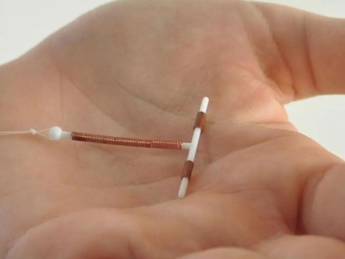 DIU Inteligente: Una Innovación en Control de Natalidad - Qué desventajas tiene el DIU Mirena diu inteligente - Qué desventajas tiene el DIU Mirena