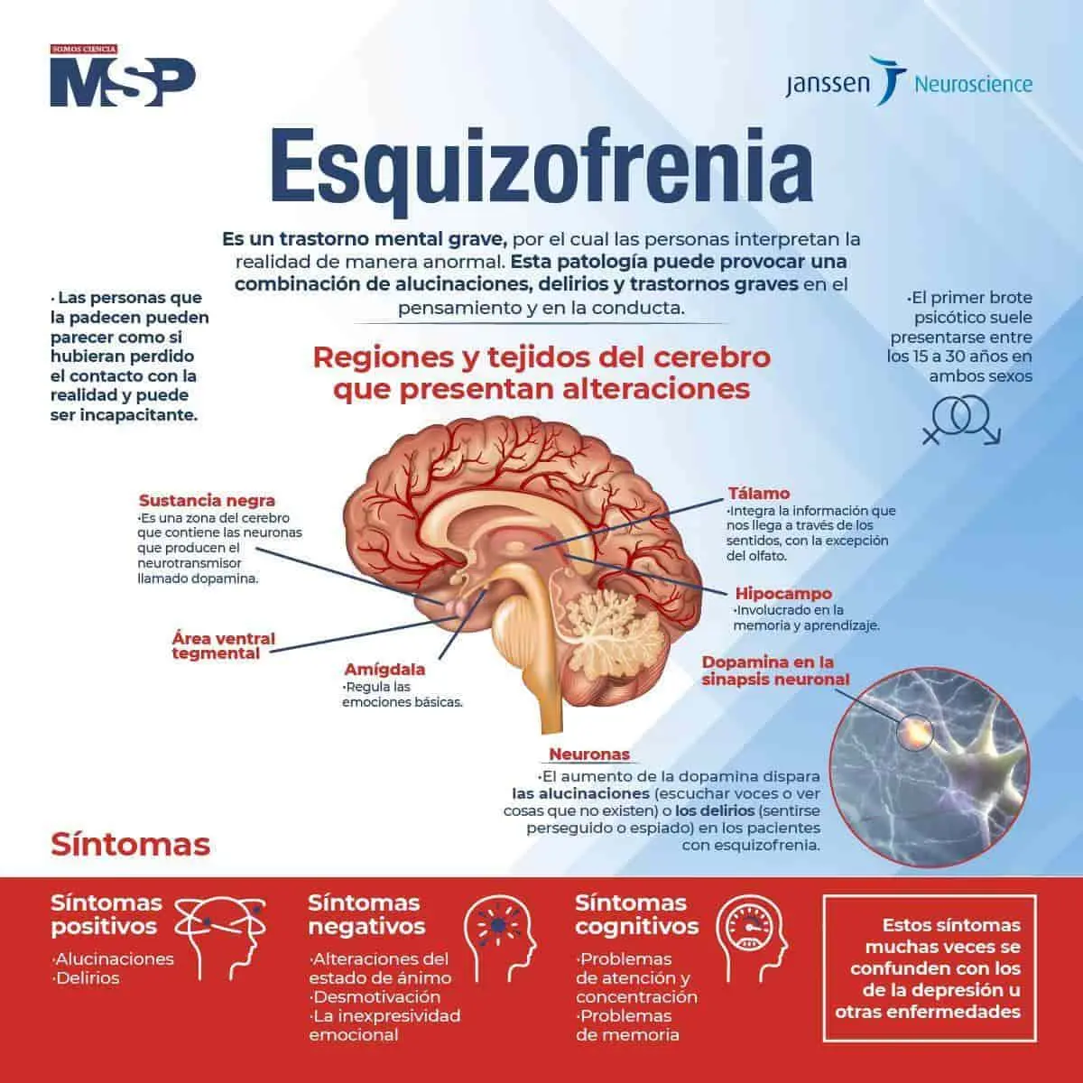 enfermedades de la esquizofrenia inteligencias multiples - Qué dice la neurociencia de la esquizofrenia