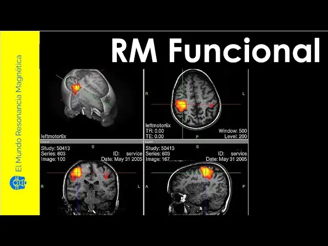 cerebros inteligentes en una resonancia magnetica funcional - Qué es un cerebro funcional