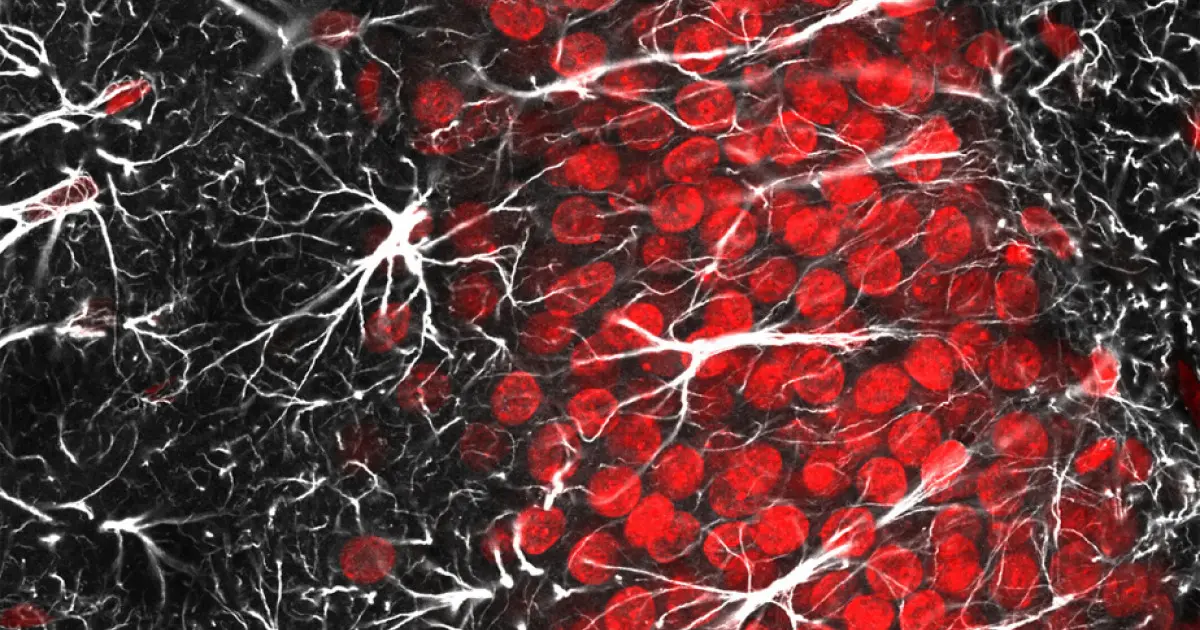 como afecta la neuroglia en la inteligencia - Qué importancia tiene la neuroglía