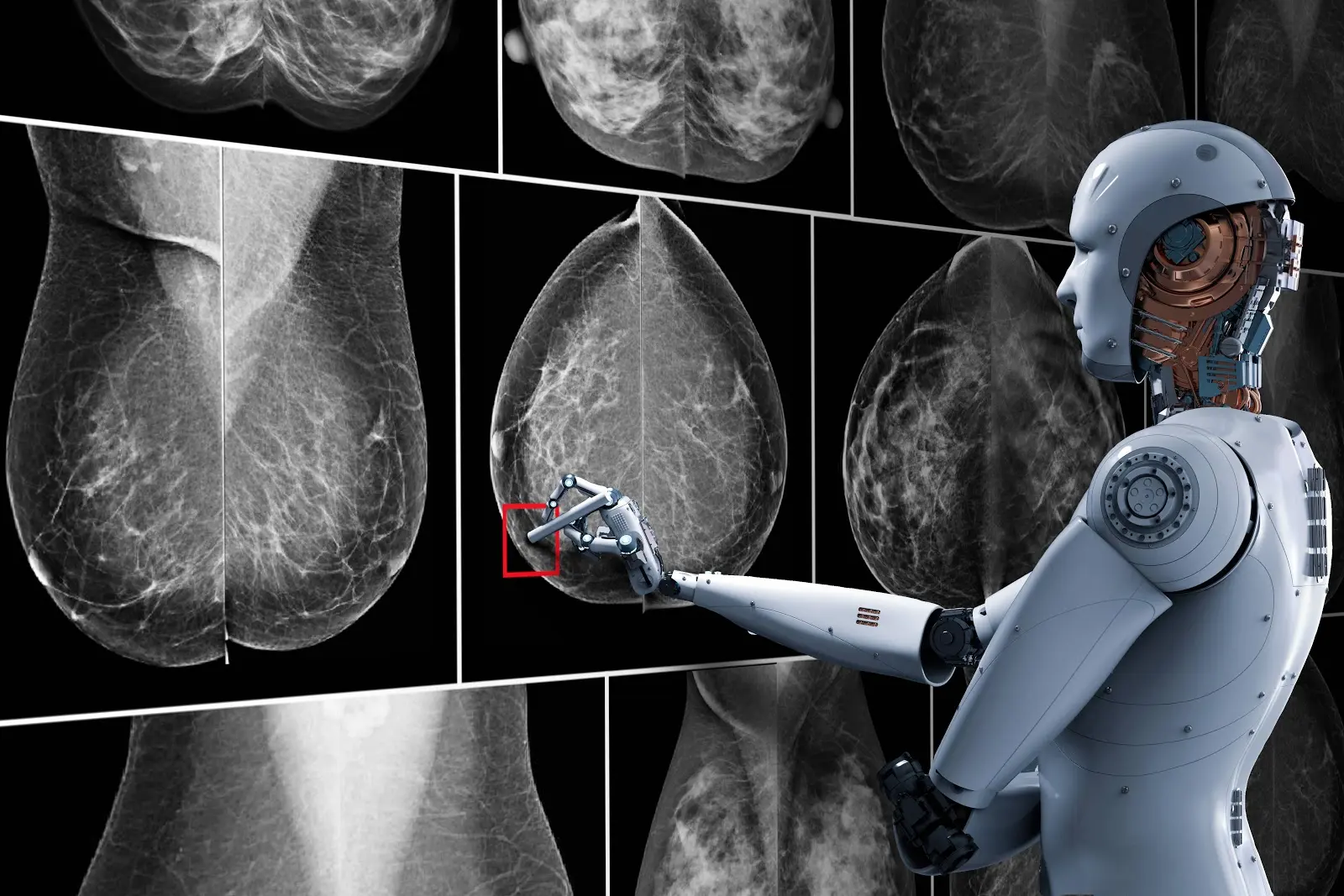 inteligencia artificial en mamografia - Qué otro examen reemplaza la mamografía