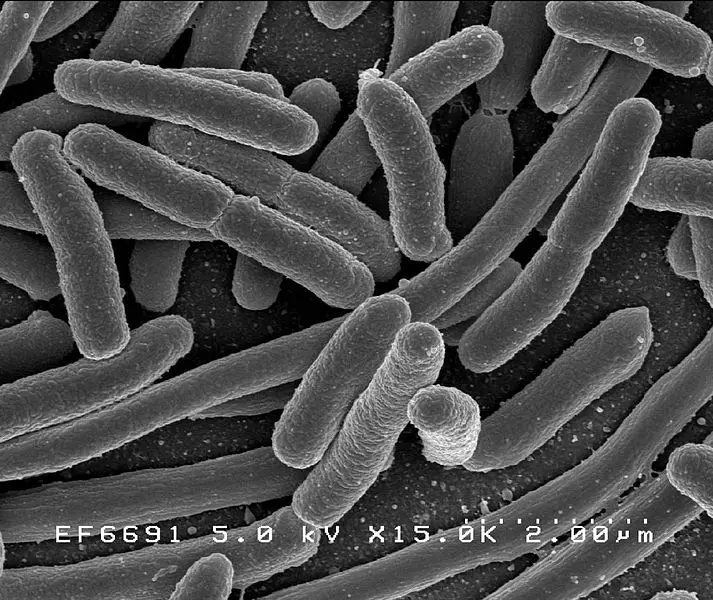 bacterias intestino e inteligencia - Qué pasa cuando hay bacterias en el intestino