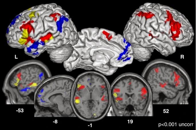 cerebros inteligentes en una resonancia magnetica funcional - Que se ve en resonancia cerebro