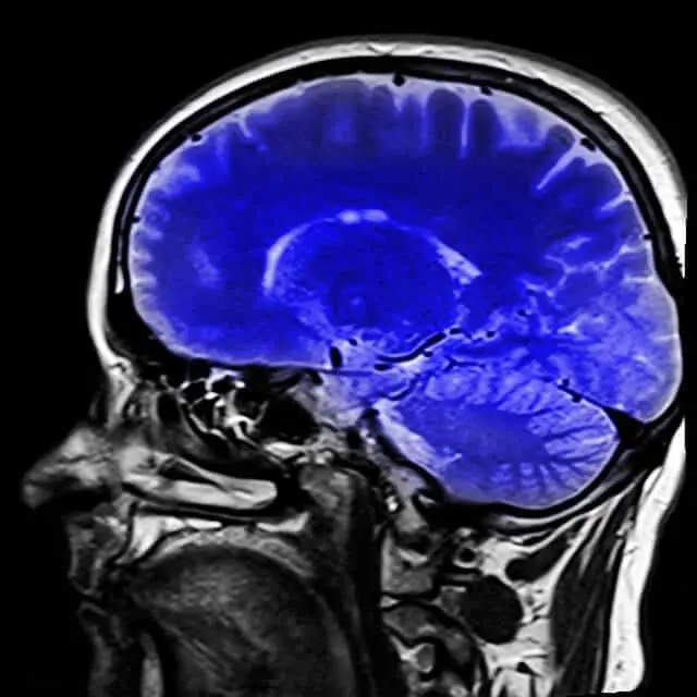 el tamaño del cerebro determina la inteligencia - Qué significa tener un cerebro grande