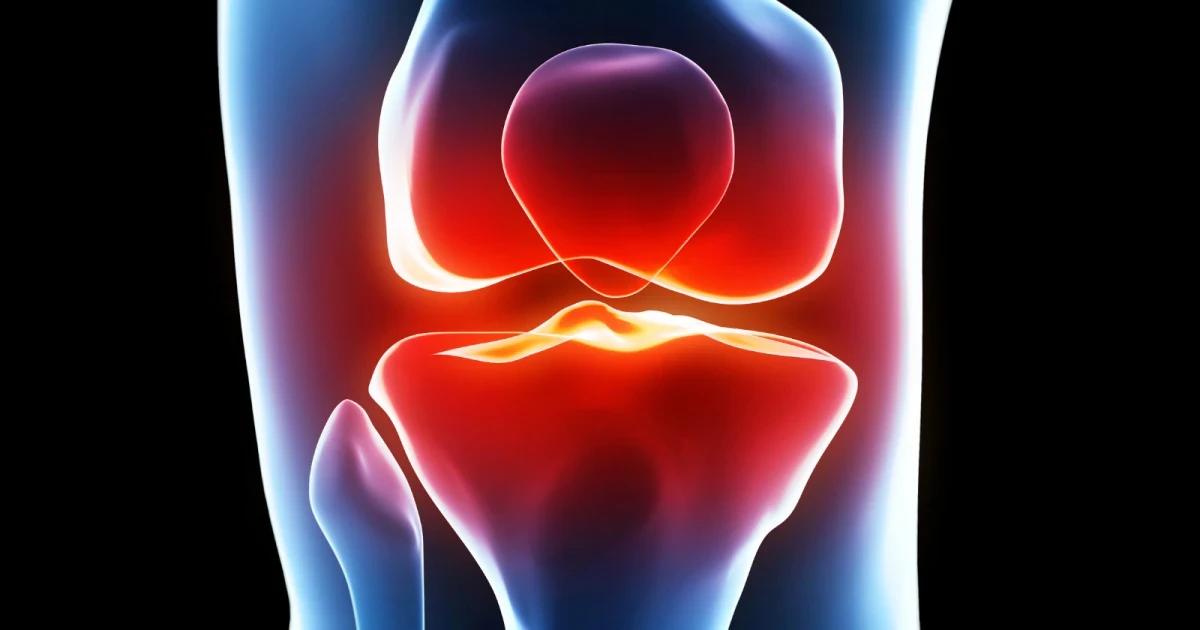 Rodilla inteligente: la nueva tecnología que revoluciona la cirugía de reemplazo de rodilla - Qué tan efectiva es la prótesis de rodilla rodilla inteligente - Qué tan efectiva es la prótesis de rodilla